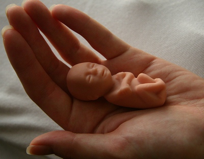 Общественное движение «За жизнь» попытается убедить парламентариев принять закон против абортов